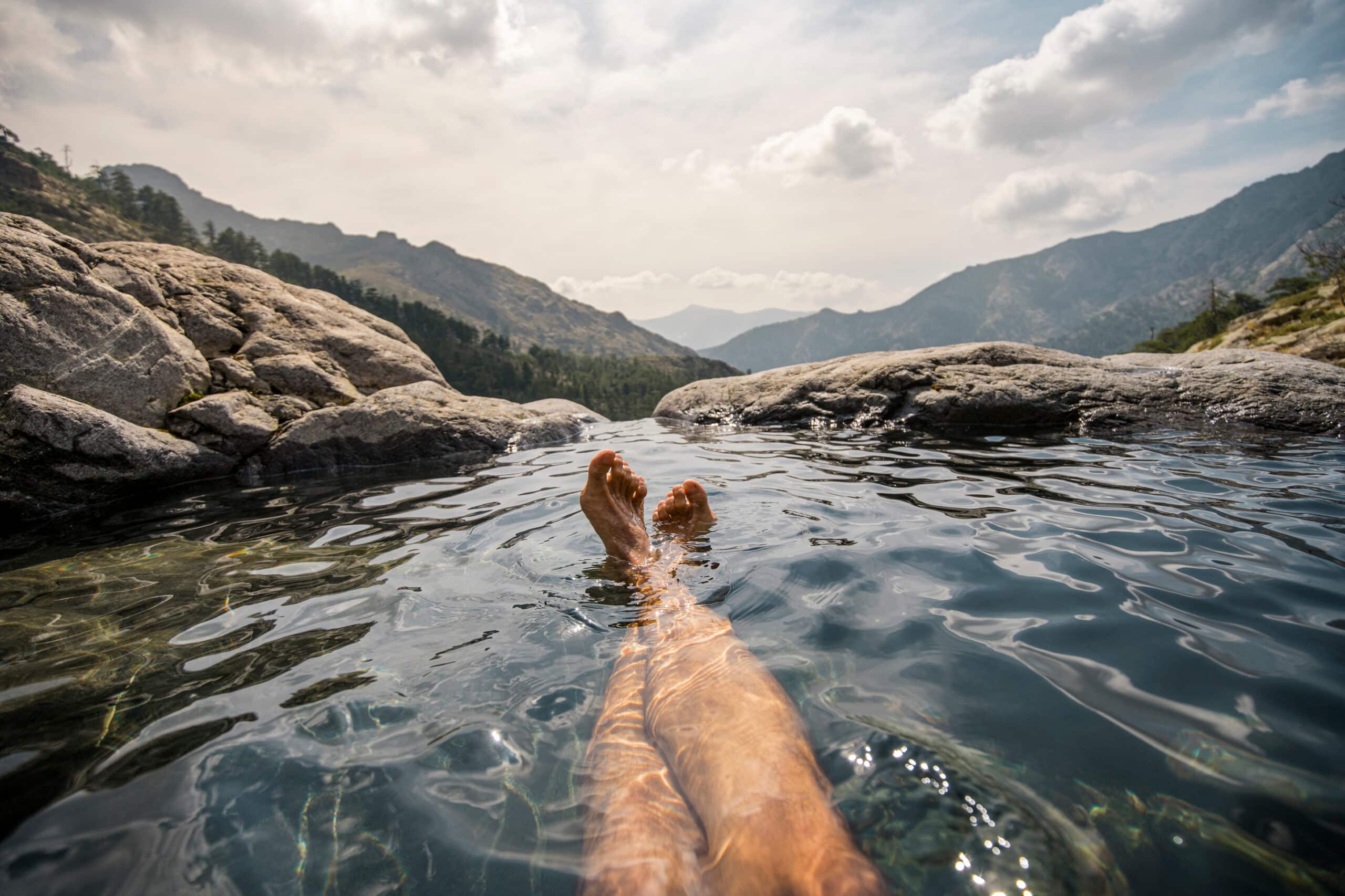 varicose veins treatment